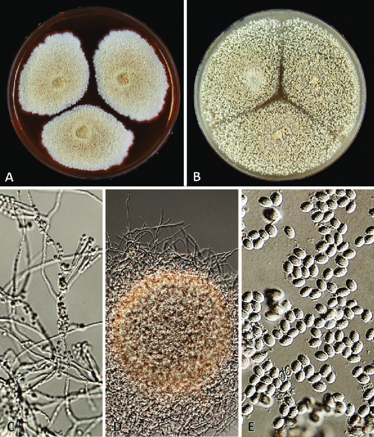 Mold Spores